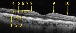Анатомия заднего отрезка глаза
