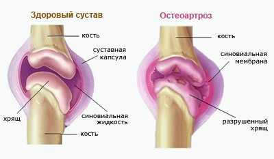 сколько стоит лечение катаракты в барнауле