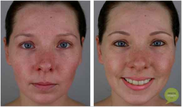 Перманентный макияж глаз межресничное пространство фото до и после отзывы