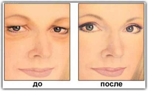 Как сделать макияж глаз если верхнее веко нависает