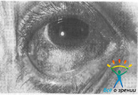 Неселективные симпатомиметики. несколько упражнений для глаз. Нестероидные противовоспалительные средства.
