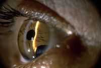 Внутренняя полость глазного яблока. Внутриглазное давление. Внутрицитоплазматические включения.