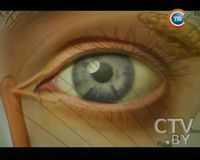 Актинические дерматиты век. Акупрессура для улучшения зрения. Алгоритмы обследования больных с подозрением на глаукому и глаукомой.