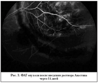 Классификационные признаки некоторых заболеваний и повреждений органа зрения. Классификация глаукомы. Классификация опухолей хориоидеи.