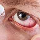 Новое устройство для лечения сухого глаза в домашних условиях