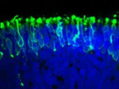 Светочувствительная сетчатка создана из стволовых клеток человека