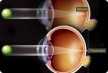 Виагра может вызвать проблемы со зрением