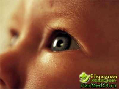 врожденная катаракта причины