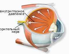 вторичная катаракта осложнения