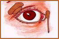 Исследование переднего отдела глаза. Исследование слезного аппарата при его заболеваниях. Исследование слезных органов.
