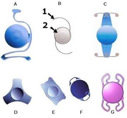 Монофокальные и торические интраокулярные линзы