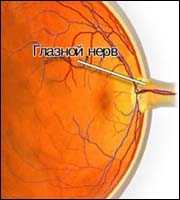 Технология изготовления контактных линз. Типы комбинированных операций на глазнице и придаточных пазухах одновременно. Токсические поражения зрительного нерва.