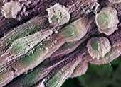 Стволовые клетки для роговицы